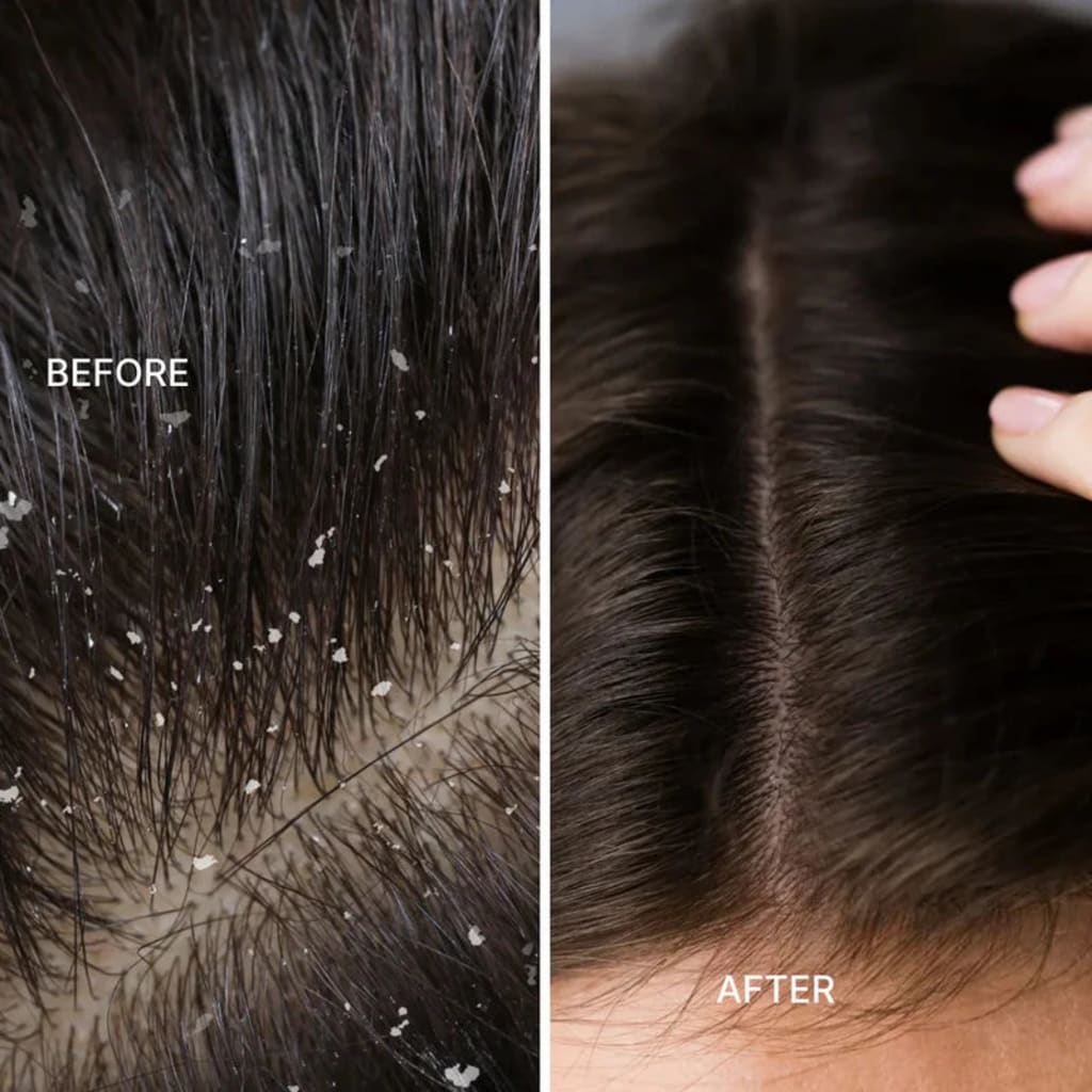 3 in 1 Electric Massage Comb